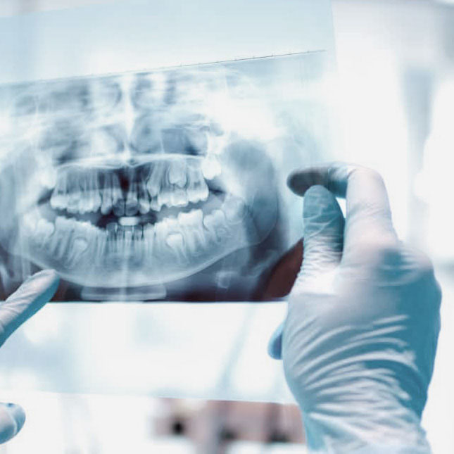 Zahnversicherung Röntgen Zahn